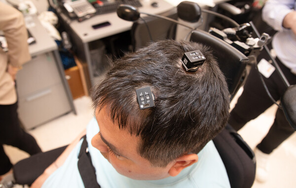 키스 토마스의 뇌에 이식된 마이크로칩 5개는 그에게 운동 능력과 감각을 되찾게 도와준다. [사진=NORTHWELL HEATH]