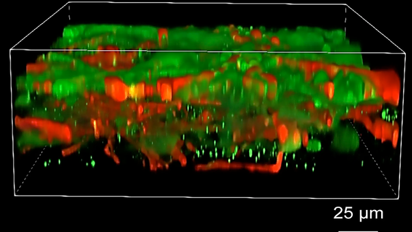새로운 토토 롤링프린팅 기술로 인쇄한 뇌세포 조직. [사진=YAN ET AL. / UW-MADISON]